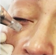 nano-eye